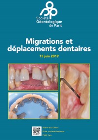 Migrations et déplacements dentaires